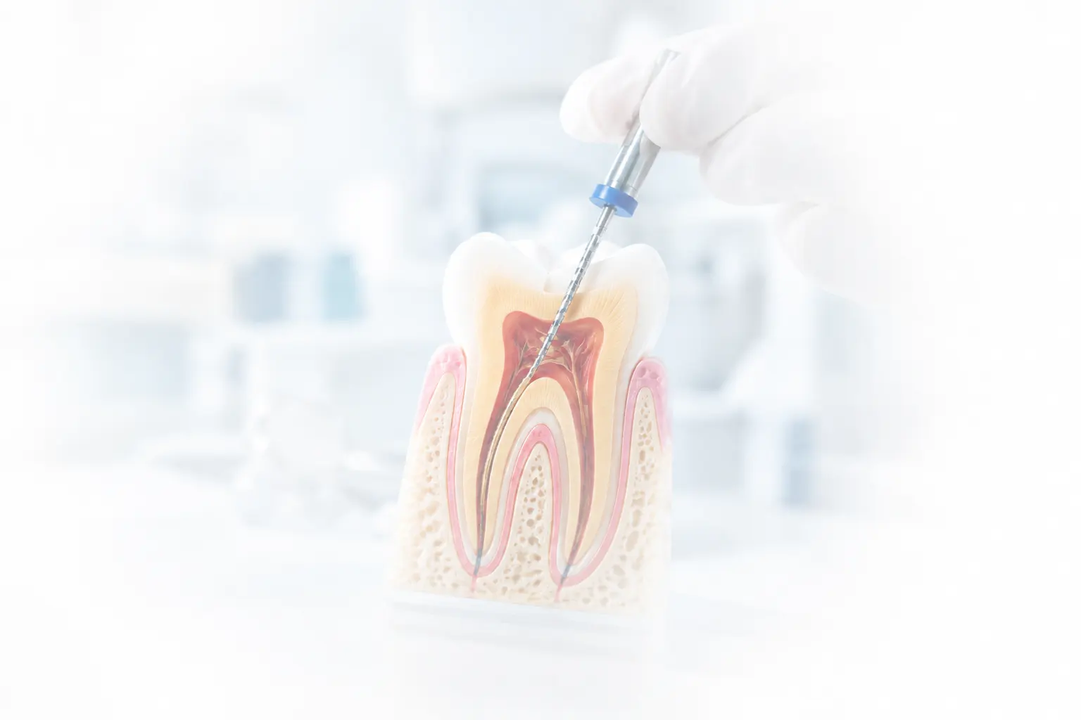 endodontics-root-canal-treatment-dental-procedure